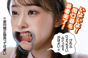 RMER-003 Orthodontic Woman Koyoi Hasegawa