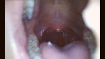 XRW-998 Throat Ma Co-injection Torture Applicant Deep Throating Himari Ogawa